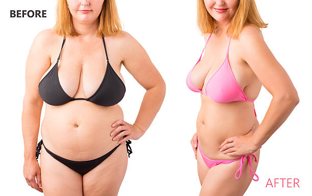 фотографија пре и после губитка тежине